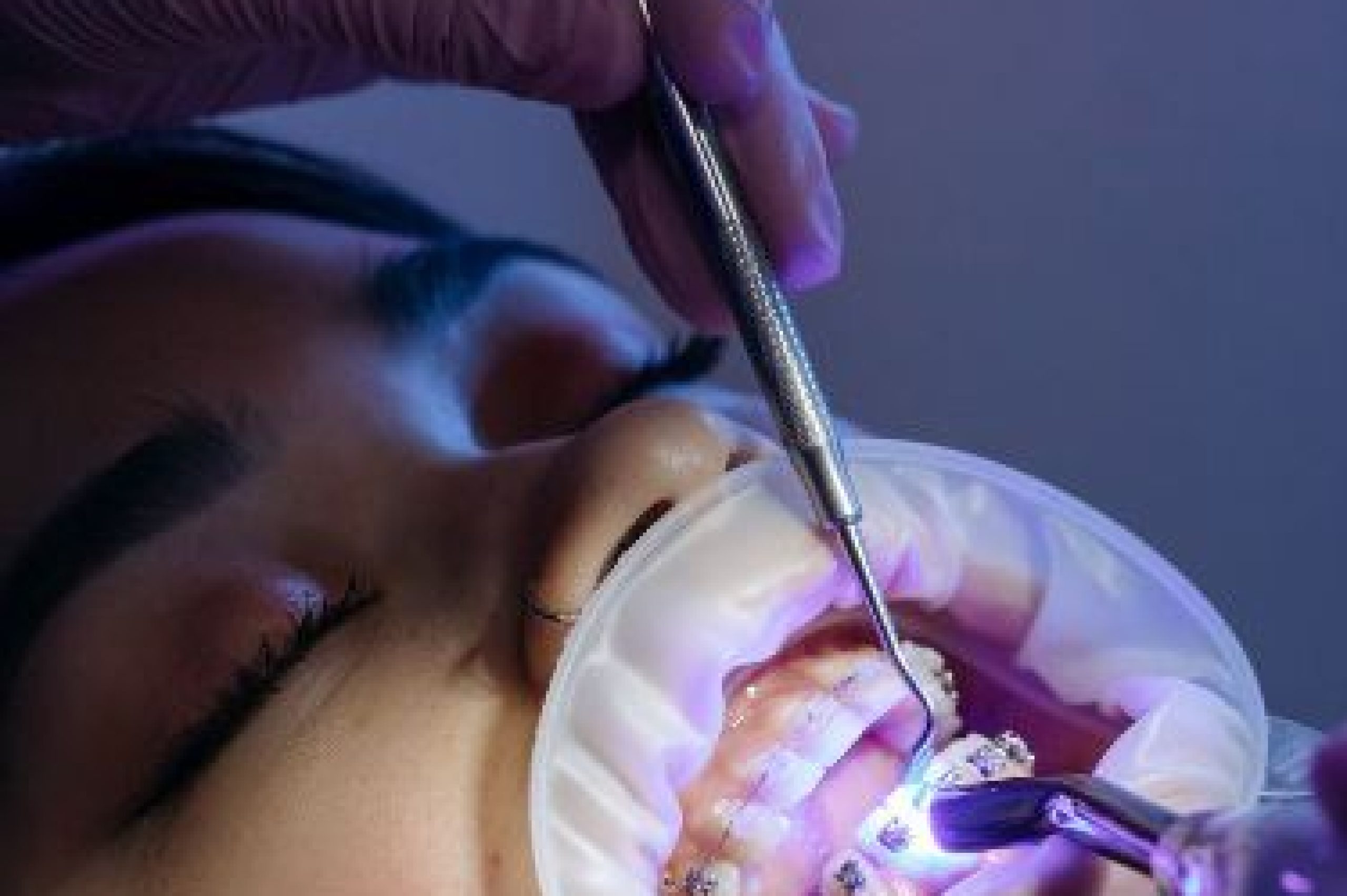 Discover Your Perfect Smile_ Orthodontist Alexandria Expertise for a Radiant Grin